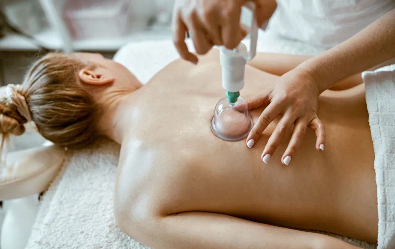 The Holistic Benefits of Cupping Therapy