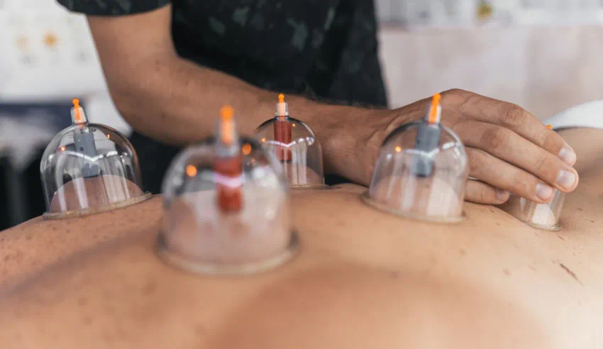Increase Athletic Performance with Cupping Therapy